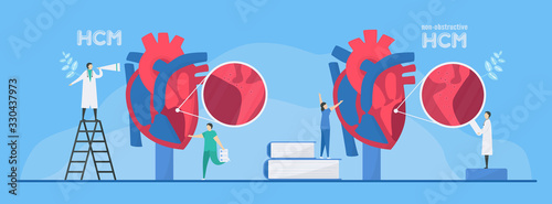 Cardiology vector illustration. This diseases are HCM and non-obstructive HCM. Ability of blood pumping is decreased. Portion of heart becomes thickened. HCM means hypertrophic cardiomyopathy.