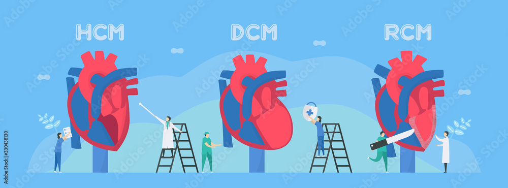 Cardiology vector illustration. This diseases are HCM, DCM, and RCM. Ability of blood pumping is decreased. CM means cardiomyopathy. Diagnostic and analysis. Flat tiny character style.