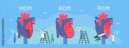 Cardiology vector illustration. This diseases are HCM, DCM, and RCM. Ability of blood pumping is decreased. CM means cardiomyopathy. Diagnostic and analysis. Flat tiny character style.