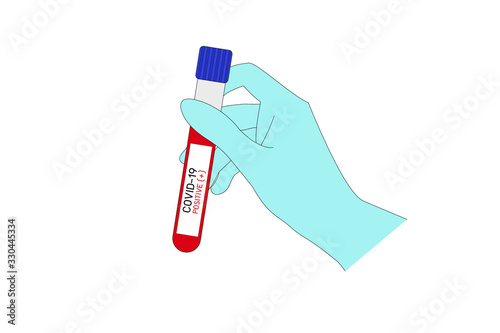 hand holding test tube with blood for covid-19 test with text “covid-19 positive (+)” isolated on white background