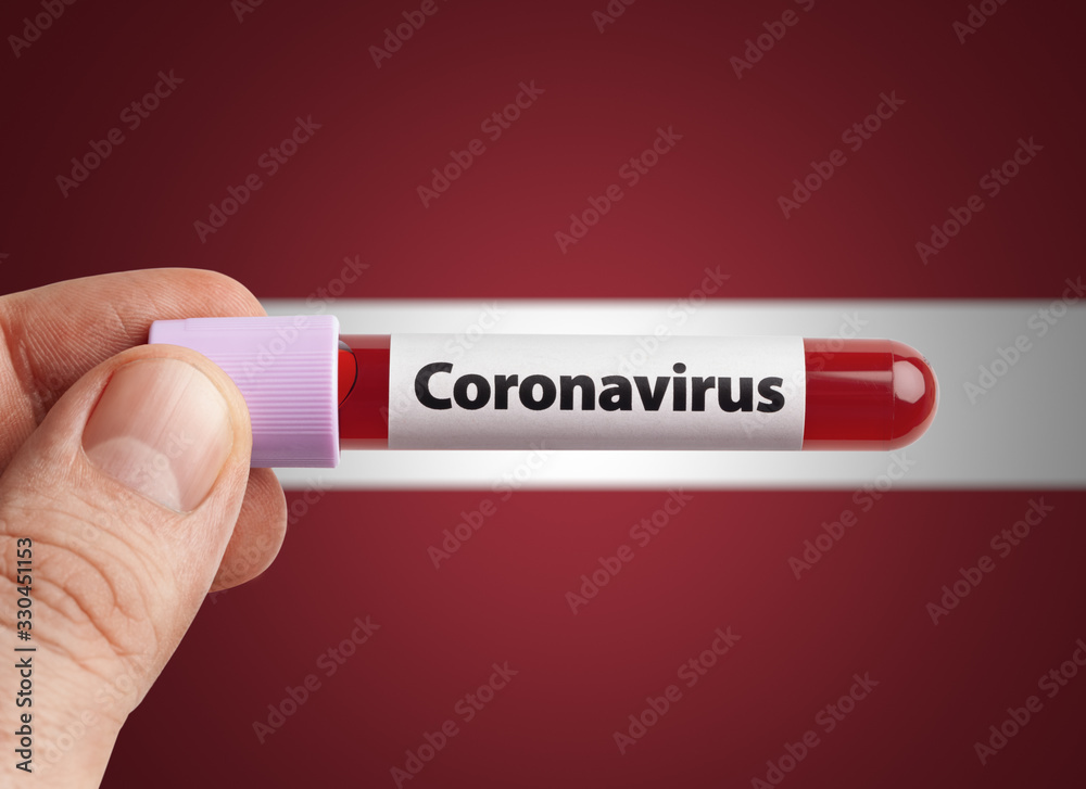 Obraz premium Scientist holding Coronavirus infected blood in test tube in front of Latvia flag. Pandemic COVID-19 infection in countries in world concept.