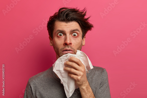 Stunned sick man has flu, virus or allergy respiratory, red watery eyes, blows nose in tissue, finds out about serious disease, poses over pink background. Health, medicine and symptoms concept