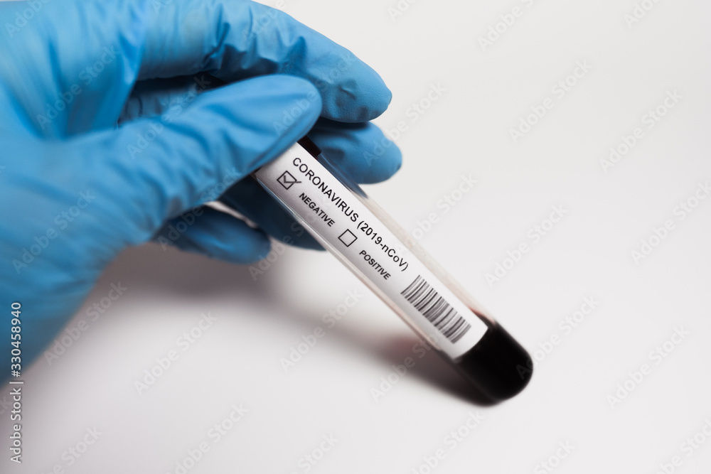 Naklejka premium Coronavirus blood test. Doctor holding a test tube. 2019-nCoV. Covid.