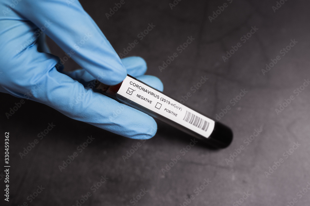Obraz premium Coronavirus blood test positive. Doctor holding a test tube. 2019-nCoV. Covid.