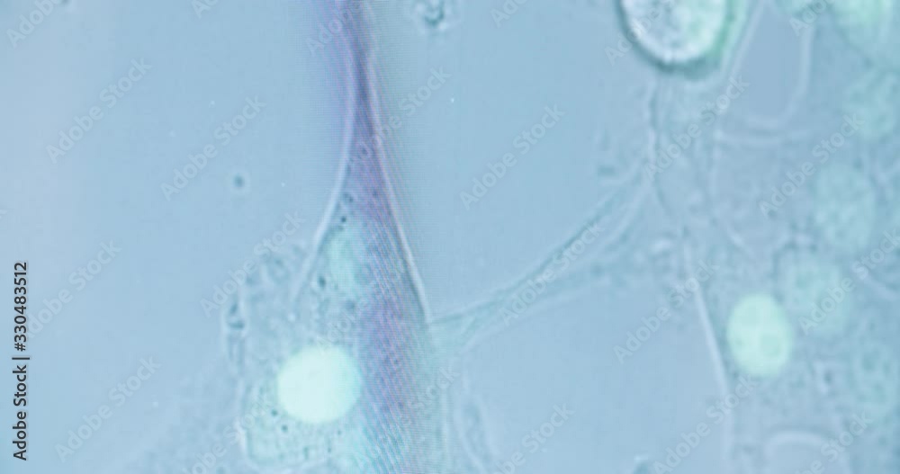 close up of bacteries moving under microscope close up of bacteries moving under microscope