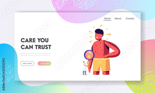 Chicken Pox Varicella Symptoms Landing Page Template. Tiny Doctor Character with Magnifying Glass Looking on Germs at Huge Boy with Red Pimples on Body. People Vaccination. Cartoon Vector Illustration