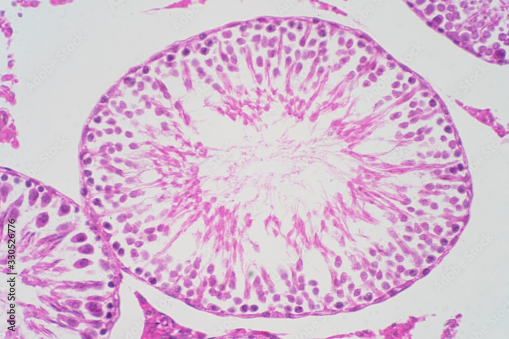 Human Testis Under Microscope View Shows Spermatogonia Spermatocytes In Meiosis Spermatids 3682