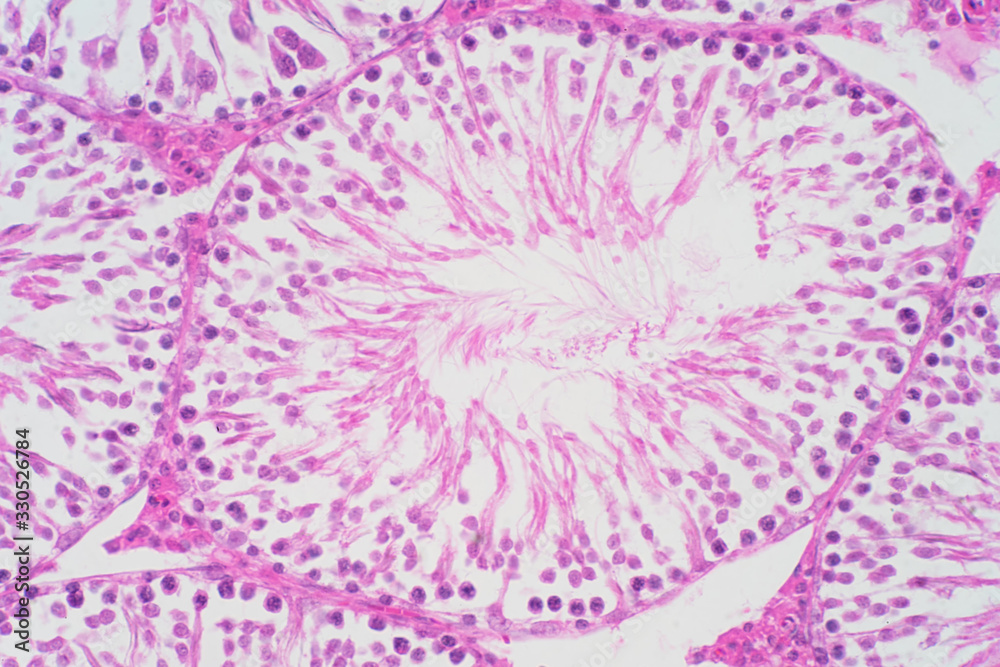 Human testis under microscope view. Shows spermatogonia, spermatocytes in meiosis, spermatids, and spermatozoa. Human testis under microscope view. Shows spermatogonia, spermatocytes in meiosis, spermatids, and spermatozoa.