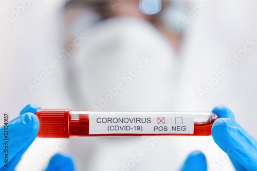 Close up of young male scientist holding test tube with blood sample for coronavirus research at clinical laboratory