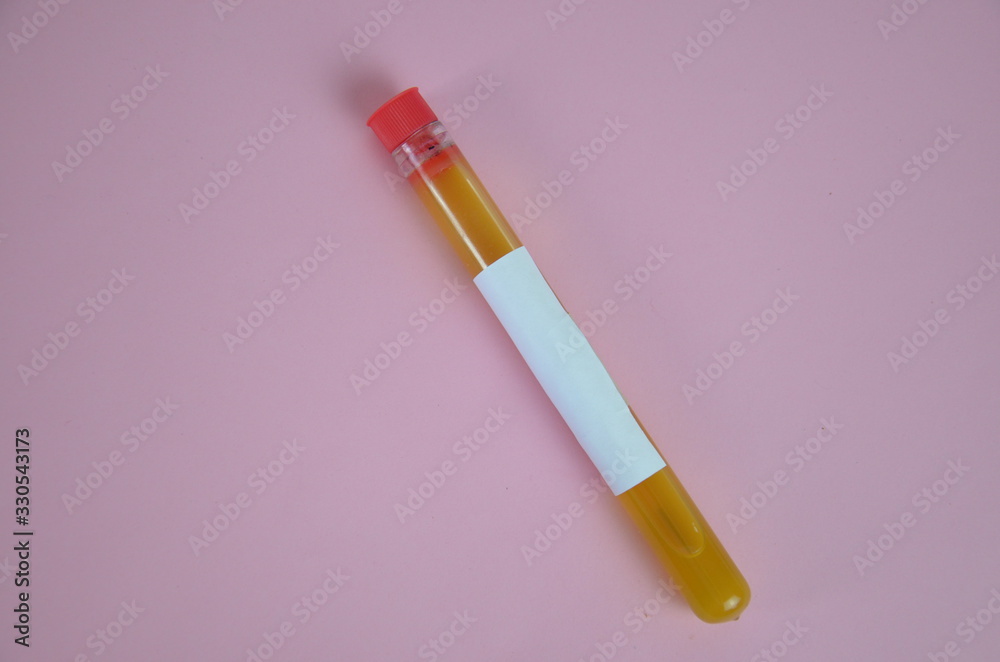 Colored liquids yellow in test tubes over pink background Colored liquids yellow in test tubes over pink background