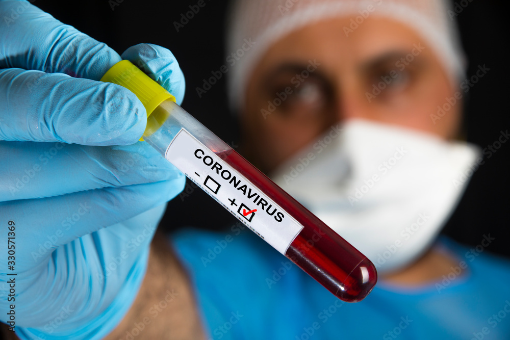 Blood sample test tube positive with label COVID-19 or novel coronavirus Blood sample test tube positive with label COVID-19 or novel coronavirus