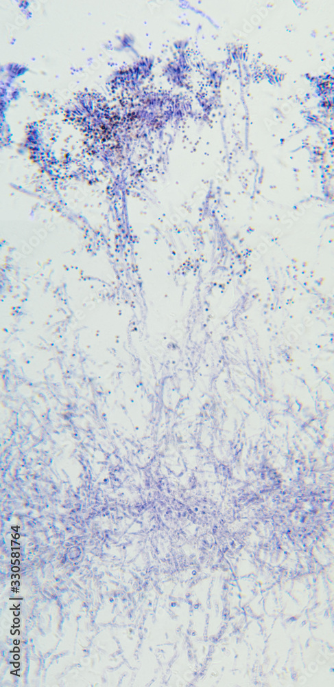 Penicillium, ascomycetous fungi, detail, under the microscope. To humans ascomycetes are a source of medicinal compounds, like antibiotics, for fermenting bread, alcoholic beverages and cheese. Photo. Penicillium, ascomycetous fungi, detail, under the microscope. To humans ascomycetes are a source of medicinal compounds, like antibiotics, for fermenting bread, alcoholic beverages and cheese. Photo.