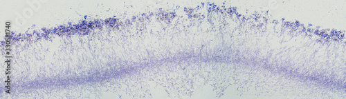 Penicillium, ascomycetous fungi, under the microscope. To humans ascomycetes are a source of medicinal compounds, such as antibiotics, for fermenting bread, alcoholic beverages and cheese. Photo.