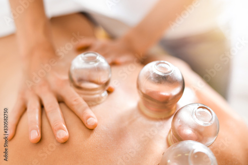 Detail of a woman therapist hands giving cupping treatment on back. photo
