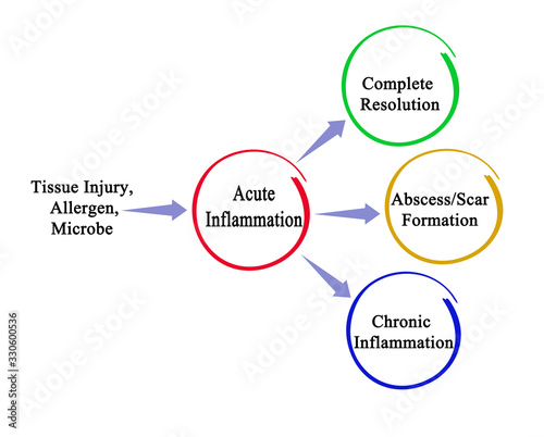 Three ways of resolution of acute inflamation