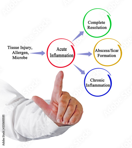 Three ways of resolution of acute inflamation