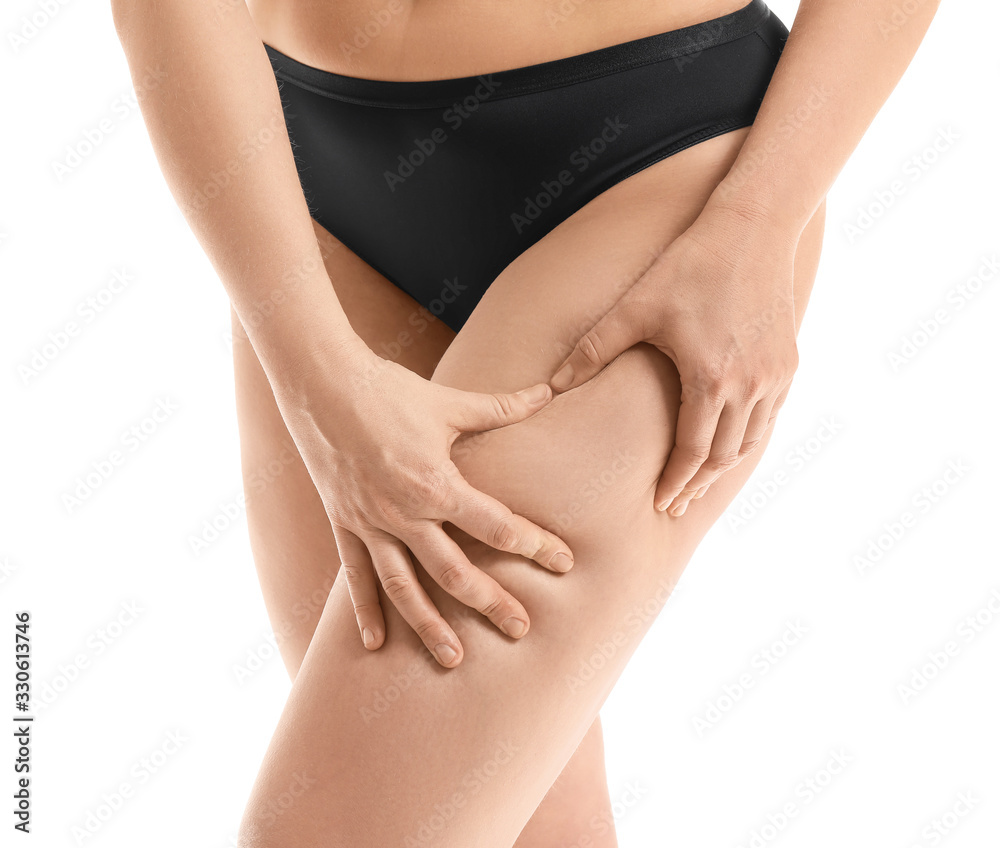 Young woman with cellulite problem on white background