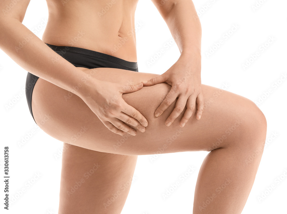 Young woman with cellulite problem on white background Young woman with cellulite problem on white background