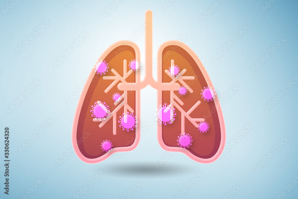 Fototapeta premium Illustration of lungs infected with coronavirus