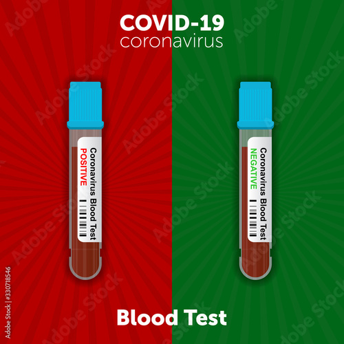 test tube containing blood that tested positive for Novel coronavirus COVID-19 in the blood