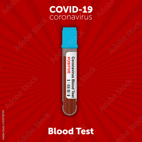 test tube containing blood that tested positive for Novel coronavirus COVID-19 in the blood