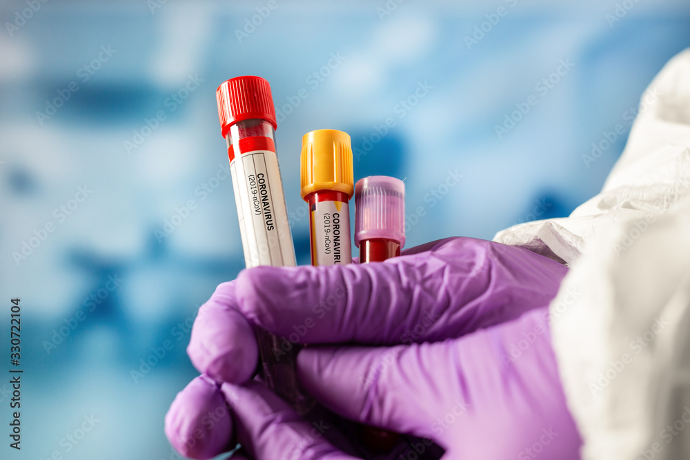 COVID-19 coronavirus concept. Doctor or lab technician holding blood sample. COVID-19 coronavirus concept. Doctor or lab technician holding blood sample.