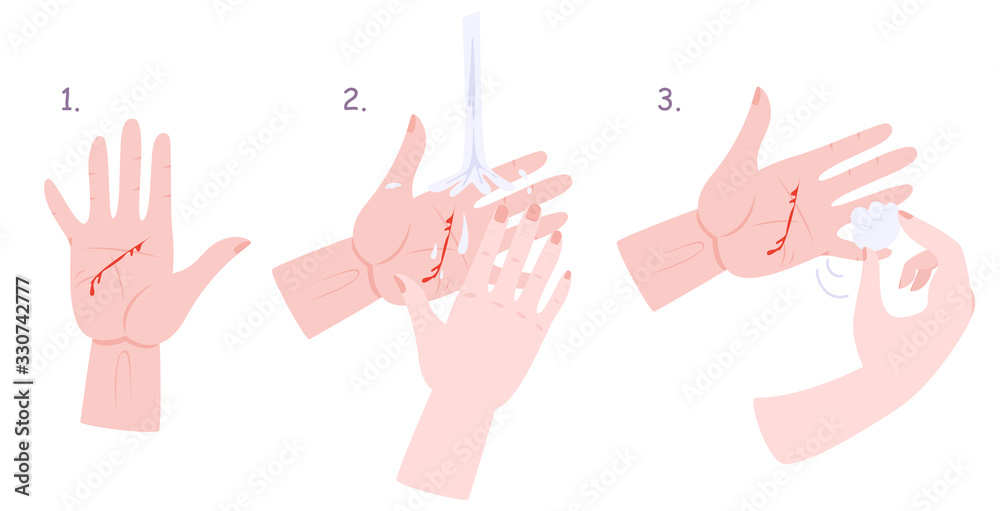Obraz premium First aid treatment for wound infographic. Bleeding cut, pain in wound.