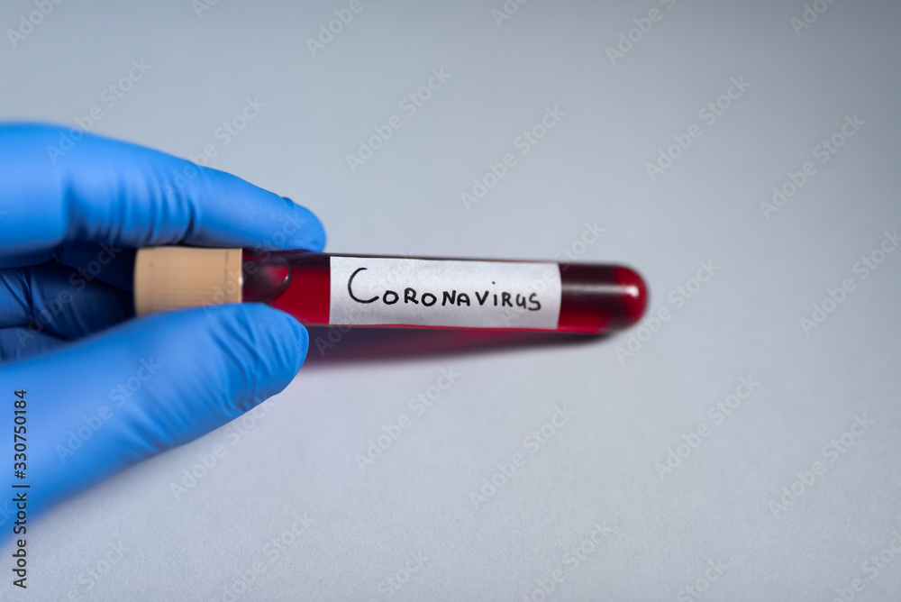 Obraz premium Test tube with coronavirus 