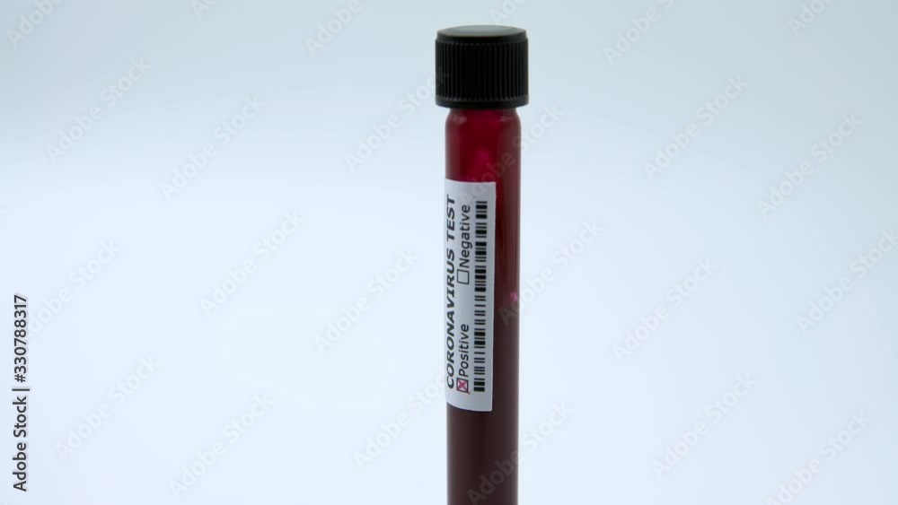 4K, Positive COVID-19 test and laboratory sample of blood testing for diagnosis new Corona virus infection. Disease 2019 from Wuhan. Pandemic infectious concept. 2019-nCoV epidemic of China.-Dan 4K, Positive COVID-19 test and laboratory sample of blood testing for diagnosis new Corona virus infection. Disease 2019 from Wuhan. Pandemic infectious concept. 2019-nCoV epidemic of China.-Dan
