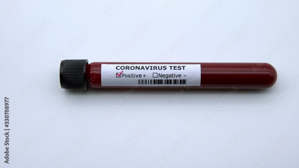 4K, Test tube with infected blood sample for COVID-19, novel coronavirus found in Wuhan, China. Vaccine research for virus 2019-nCoV. Concept of against transmissible infectious diseases-Dan 4K, Test tube with infected blood sample for COVID-19, novel coronavirus found in Wuhan, China. Vaccine research for virus 2019-nCoV. Concept of against transmissible infectious diseases-Dan