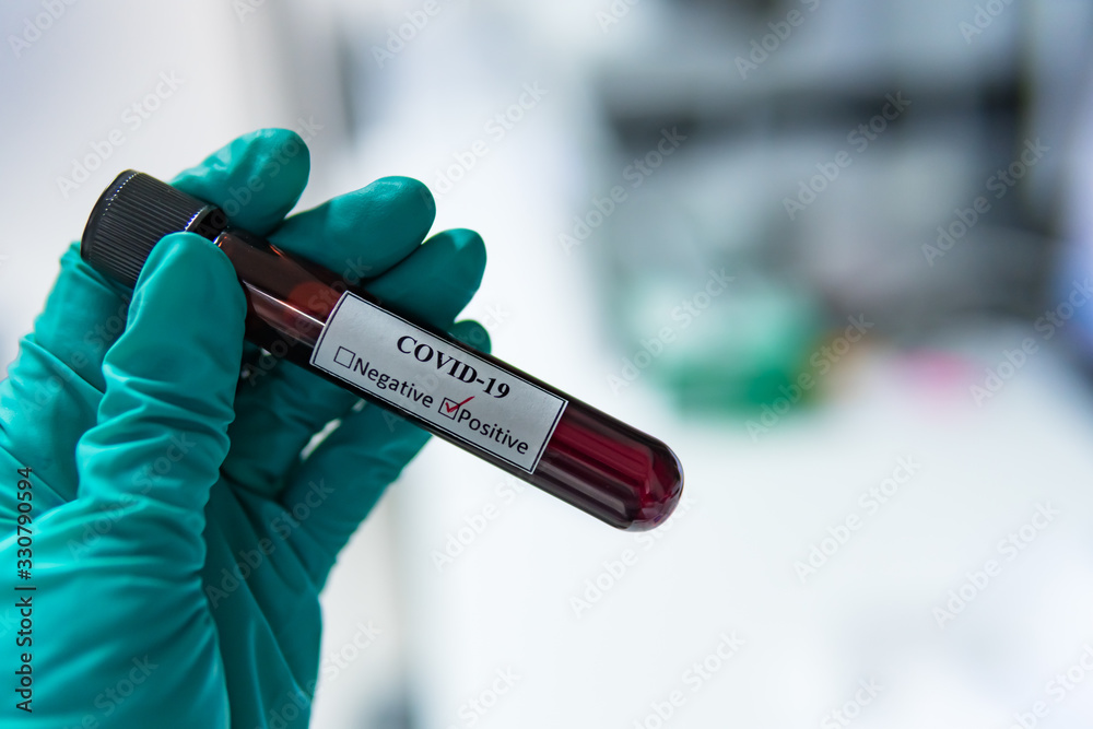 Obraz premium Scientist holding Test tube with blood sample for COVID-19 test,Experiment to detect virus was found in the blood.