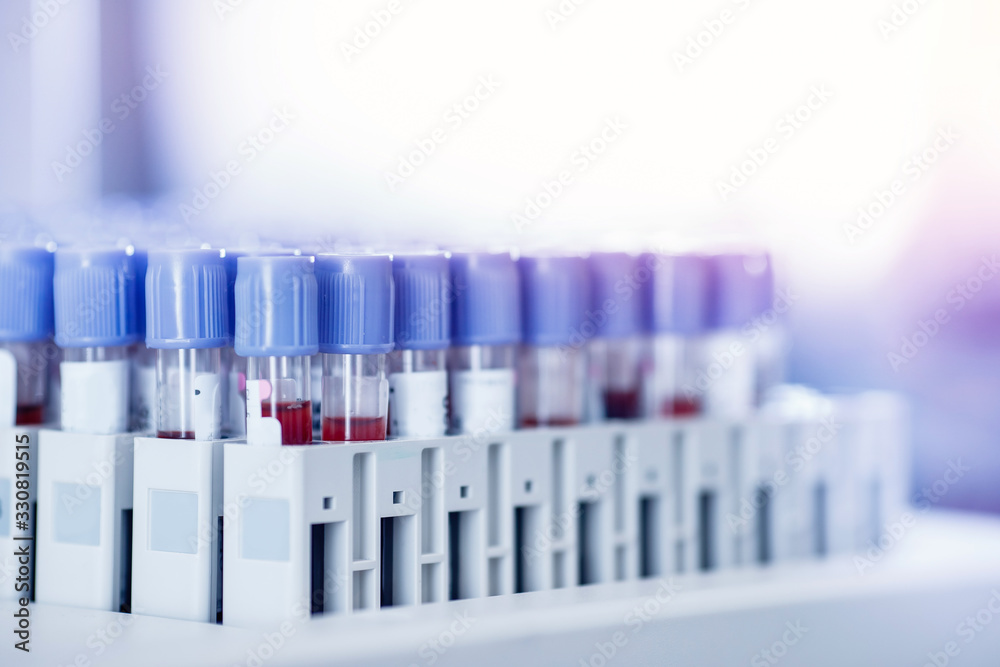 Blood test tube laboratory for analysis with virus epidemic