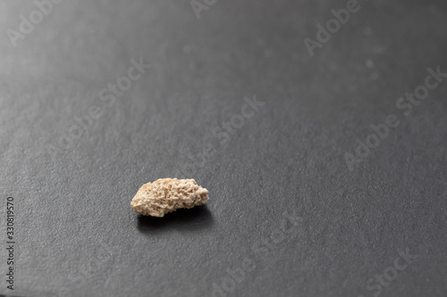 5 mm Nierenstein auf schwarzer Oberfläche photo