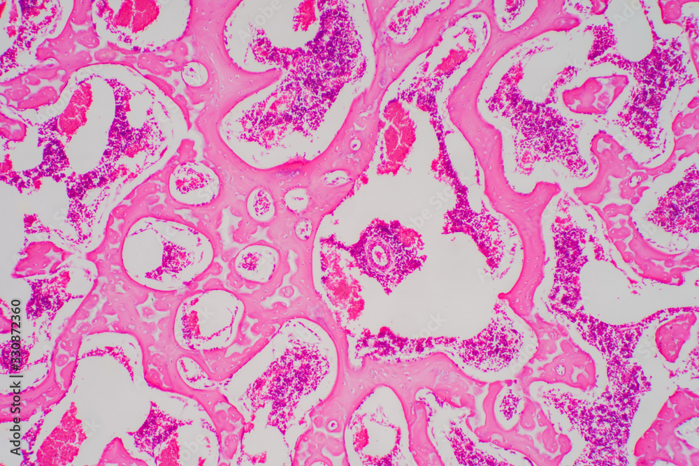 Human Hyaline cartilage bone under microscope view for education