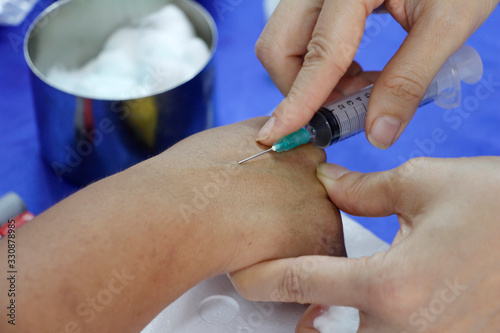 The doctor is using a vial of syringes.