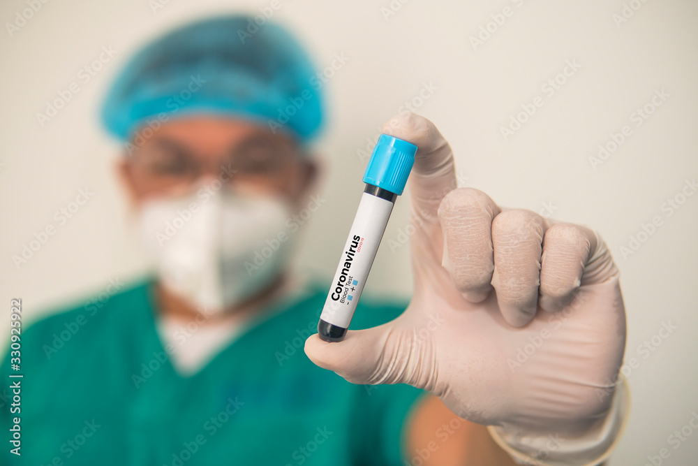 Coronavirus 2019-nCoV Blood Sample. Corona virus outbreaking. Corona Virus in Lab. Scientist hold a tube with Blood Test and Barcode with the Virus Name Coronavirus . New Epidemic Corona Virus