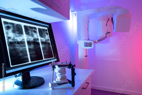farblose Zahnschiene im Artikulator, Anwendung und Programmierung mit Hilfe eines 3d Röntgengerät