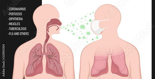 Infection is transmitted by airborne droplets. Мan wears a protective mask. Protection against virus. The spread of coronavirus, tuberculosis, influenza and other