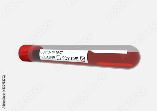 Coronavirus COVID-19 test probe blood positive result. 3d Illustration of positive virus test. Pandemic worldwide alert