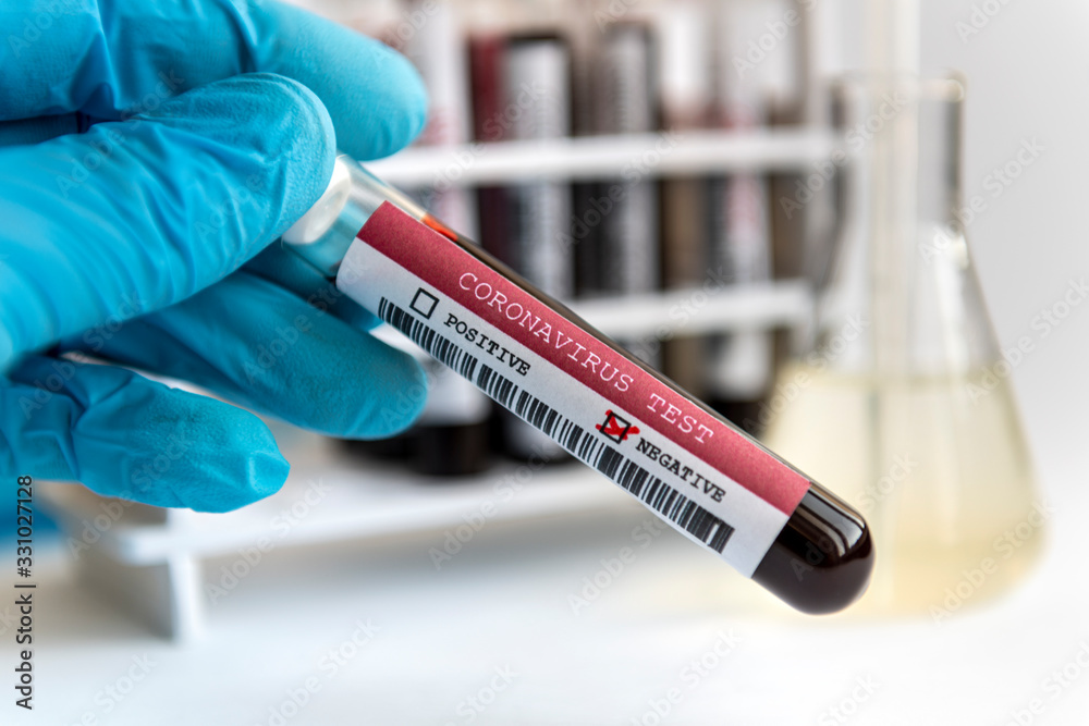 Naklejka premium Negative COVID-19 blood glass tube test