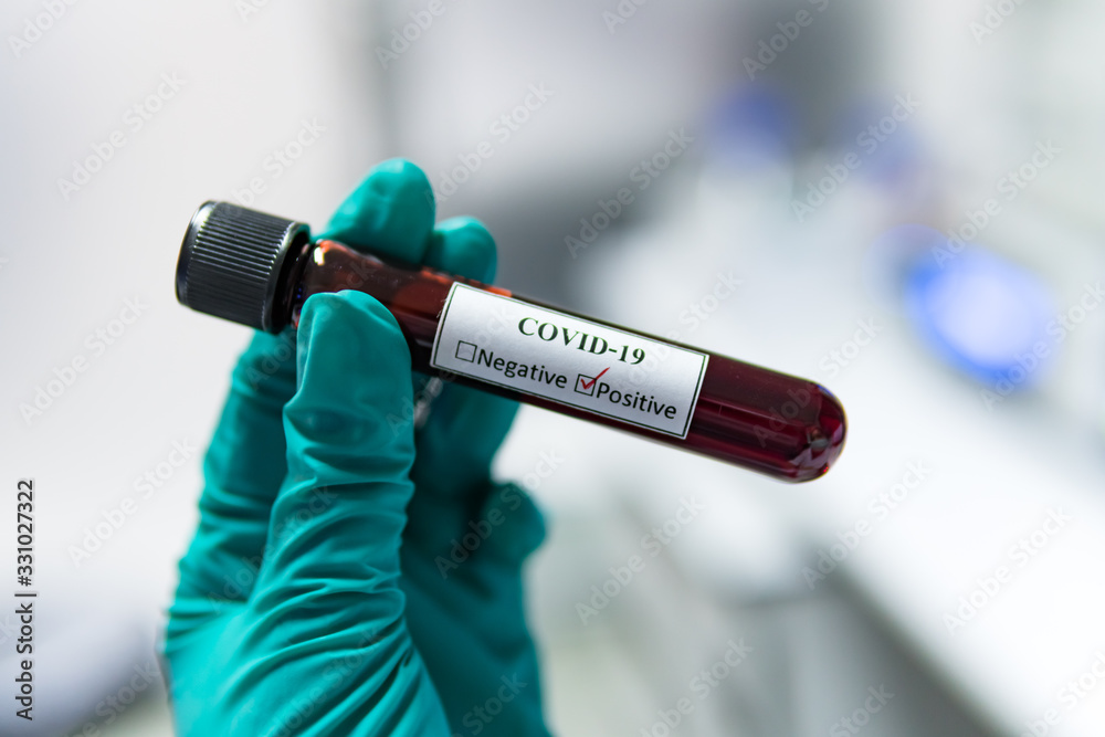 Naklejka premium Scientist holding Test tube with blood sample for COVID-19 test,Experiment to detect virus was found in the blood.