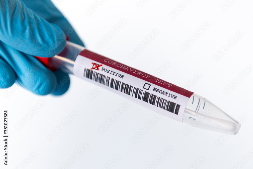 Obraz premium Hand with spatula positive Coronavirus test