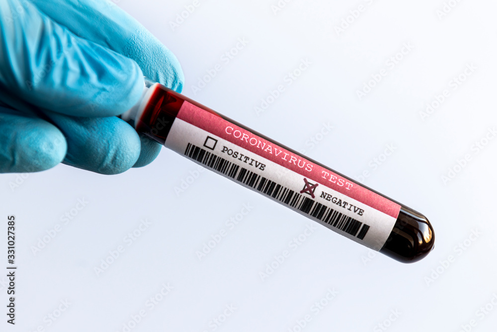 Fototapeta premium Hand with Negative COVID-19 blood glass tube test