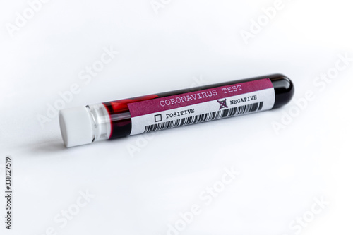 Negative COVID-19 blood glass tube test