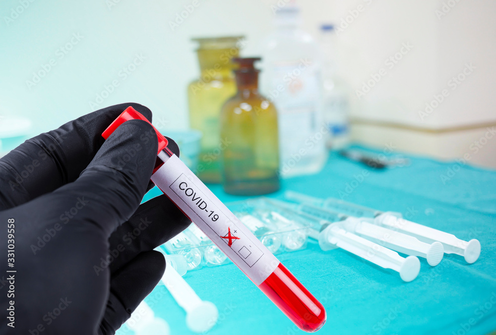 Coronavirus, covid-19, ncov-2019, blood test, hospital