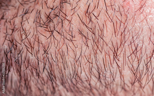background with a man's chin skin texture covered with fine and coarse hairs and bristles and scales