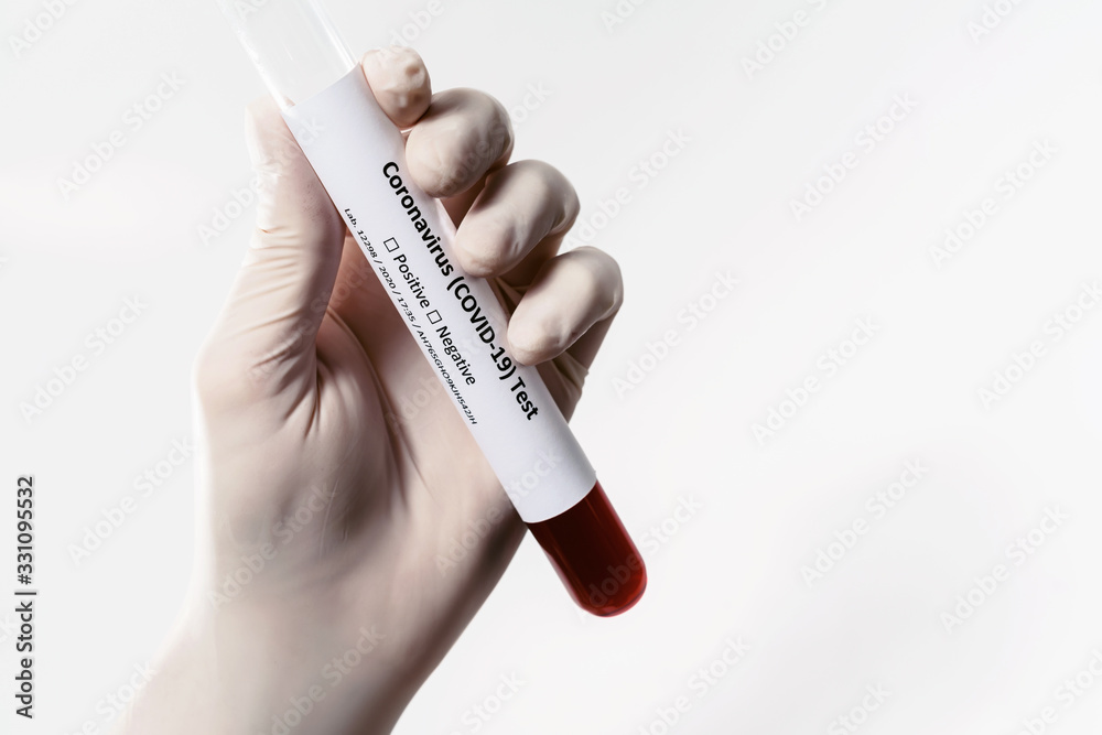 Naklejka premium Coronavirus Covid 19 infected blood sample in tube in hand of scientist doctor in medical gloves isolated at white background. Corona virus prevention