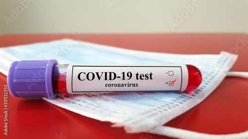 Positive COVID-19 test and laboratory sample of blood testing for diagnosis new Corona virus infection(novel corona virus disease 2019)from Wuhan with hospital background. Pandemic infectious concept photo