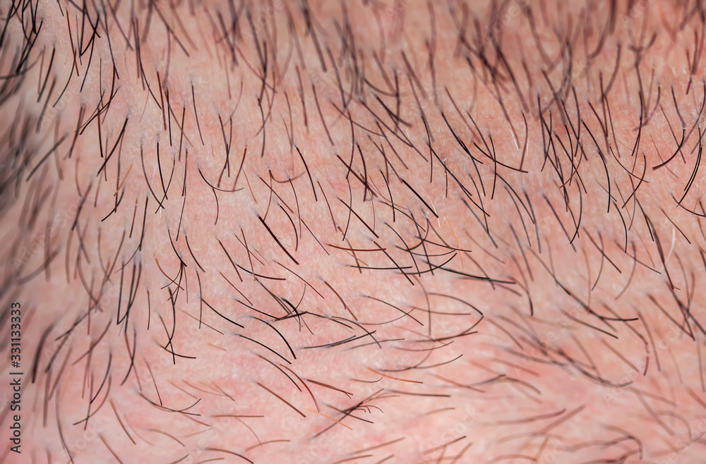 skin texture of a young man covered with hair and bristles of different ...