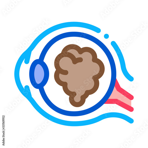 Cataract Eyes Icon Vector. Outline Cataract Eyes Sign. Isolated Contour Symbol Illustration